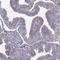 Armadillo Repeat Containing 3 antibody, NBP1-85394, Novus Biologicals, Immunohistochemistry frozen image 