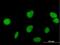Zinc Finger Protein 573 antibody, H00126231-B01P, Novus Biologicals, Immunocytochemistry image 
