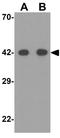Sialic Acid Binding Ig Like Lectin 15 antibody, GTX32061, GeneTex, Western Blot image 