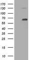 Pyruvate Kinase L/R antibody, TA501413S, Origene, Western Blot image 