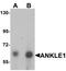 Ankyrin Repeat And LEM Domain Containing 1 antibody, orb178887, Biorbyt, Western Blot image 