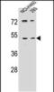 Serine Protease 55 antibody, PA5-48266, Invitrogen Antibodies, Western Blot image 