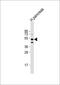 Gastric Inhibitory Polypeptide Receptor antibody, GTX81409, GeneTex, Western Blot image 
