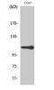 5'-3' Exoribonuclease 2 antibody, STJ96287, St John