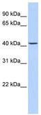 Jumonji domain-containing protein 5 antibody, TA333664, Origene, Western Blot image 