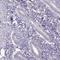 Glutamate Ionotropic Receptor Delta Type Subunit 2 antibody, HPA058538, Atlas Antibodies, Immunohistochemistry paraffin image 