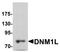Dynamin-1-like protein antibody, TA326690, Origene, Western Blot image 