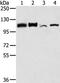 Lon protease homolog, mitochondrial antibody, PA5-50823, Invitrogen Antibodies, Western Blot image 