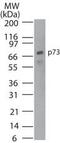 Tumor Protein P73 antibody, MA1-41175, Invitrogen Antibodies, Western Blot image 