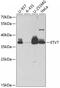 ETV7 antibody, 22-086, ProSci, Western Blot image 