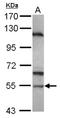 Sperm Associated Antigen 6 antibody, NBP2-20462, Novus Biologicals, Western Blot image 