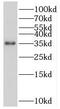 SRY-Box 2 antibody, FNab08126, FineTest, Western Blot image 