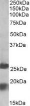 Protein Mpv17 antibody, TA311233, Origene, Western Blot image 