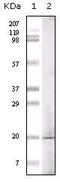 Histone-lysine N-methyltransferase EHMT1 antibody, MA5-15277, Invitrogen Antibodies, Western Blot image 