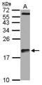 Actin Related Protein 2/3 Complex Subunit 5 Like antibody, NBP2-15472, Novus Biologicals, Western Blot image 