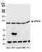 VPS18 Core Subunit Of CORVET And HOPS Complexes antibody, A305-542A, Bethyl Labs, Western Blot image 