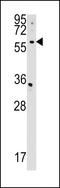 CDP-Diacylglycerol Synthase 2 antibody, LS-C168637, Lifespan Biosciences, Western Blot image 