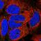 Ectodysplasin A antibody, HPA037972, Atlas Antibodies, Immunofluorescence image 