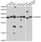 Charged Multivesicular Body Protein 4B antibody, STJ29539, St John
