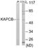 Protein Kinase CAMP-Activated Catalytic Subunit Beta antibody, EKC1691, Boster Biological Technology, Western Blot image 