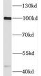Histocompatibility Minor 13 antibody, FNab08190, FineTest, Western Blot image 