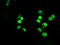 SATB Homeobox 1 antibody, TA500589, Origene, Immunofluorescence image 