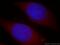 N(Alpha)-Acetyltransferase 15, NatA Auxiliary Subunit antibody, 19188-1-AP, Proteintech Group, Immunofluorescence image 
