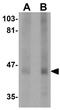 Pleckstrin Homology Domain Containing O1 antibody, GTX85240, GeneTex, Western Blot image 
