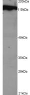 Damage Specific DNA Binding Protein 1 antibody, STJ70011, St John