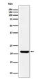 Inosine Triphosphatase antibody, M02304, Boster Biological Technology, Western Blot image 
