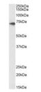ATP Binding Cassette Subfamily D Member 3 antibody, orb372997, Biorbyt, Western Blot image 