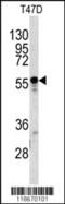 Alpha-1-B Glycoprotein antibody, 62-821, ProSci, Western Blot image 
