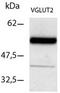Solute Carrier Family 17 Member 6 antibody, AP55381PU-N, Origene, Western Blot image 