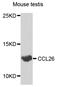 C-C Motif Chemokine Ligand 26 antibody, abx005416, Abbexa, Western Blot image 