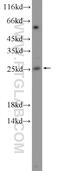 Nicotinamide Nucleotide Adenylyltransferase 3 antibody, 13236-1-AP, Proteintech Group, Western Blot image 