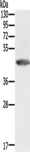 Galactose-1-phosphate uridylyltransferase antibody, TA350006, Origene, Western Blot image 