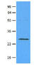 RAB5A, Member RAS Oncogene Family antibody, AM09031PU-S, Origene, Western Blot image 