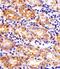 SLC22A2 antibody, M01612, Boster Biological Technology, Immunohistochemistry paraffin image 