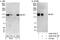 Stromal Antigen 1 antibody, A302-579A, Bethyl Labs, Western Blot image 