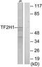 General Transcription Factor IIH Subunit 1 antibody, TA313983, Origene, Western Blot image 