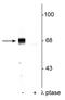 P21 (RAC1) Activated Kinase 1 antibody, P00454-1, Boster Biological Technology, Western Blot image 