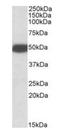 5-Hydroxytryptamine Receptor 3B antibody, orb125171, Biorbyt, Western Blot image 