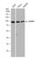 EWS RNA Binding Protein 1 antibody, NBP2-16389, Novus Biologicals, Western Blot image 