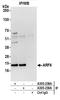 ADP Ribosylation Factor 6 antibody, A305-238A, Bethyl Labs, Immunoprecipitation image 