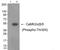 Calcium/Calmodulin Dependent Protein Kinase II Beta antibody, AP55687PU-N, Origene, Western Blot image 