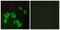 Forkhead box protein E1 antibody, LS-C120492, Lifespan Biosciences, Immunofluorescence image 
