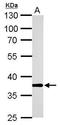 Aldo-Keto Reductase Family 1 Member B10 antibody, TA308188, Origene, Western Blot image 