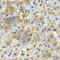 Desmoplakin antibody, A7635, ABclonal Technology, Immunohistochemistry paraffin image 
