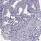 NUT Midline Carcinoma Family Member 1 antibody, HPA040421, Atlas Antibodies, Immunohistochemistry paraffin image 