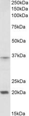 Homeobox A9 antibody, EB10045, Everest Biotech, Western Blot image 